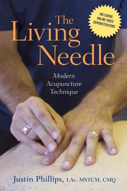The living needle - modern acupuncture technique